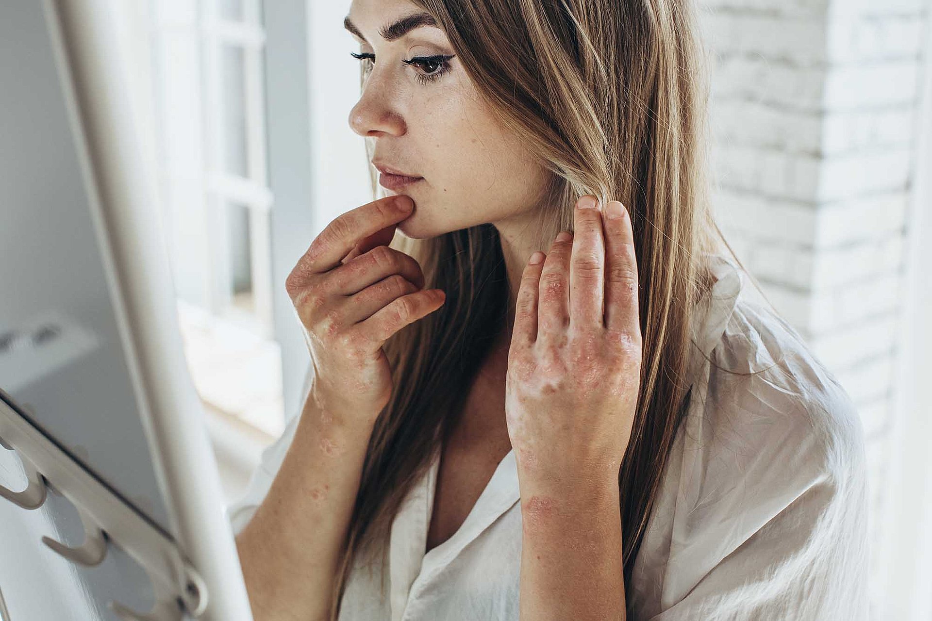 Rohrhof-Apotheke | Psoriasis Eine Frau steht vor einem Spiegel, eine Hand am Kinn, mit der anderen Hand hält sie ihre langen Haare weg vom Hals. Sie betrachtet die Hautveränderung an Hals und Dekolette und Händen.